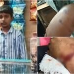 Mumbai: 12-Year-Old Boy Attacked By Unleashed German Shepherd In Ghatkopar; Dog Owner Booked For Negligence